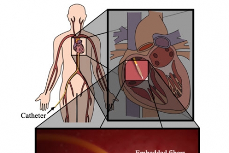 심장 수술 안정성 높일 인공 근육 형태의 초소형 유연 구동기 개발