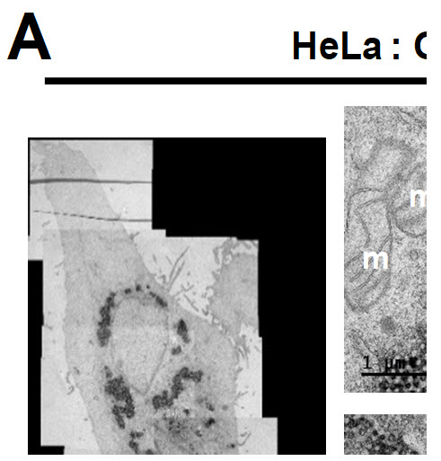 그림 1. 인간세포 내 SARS-CoV-2 단백질인 ORF3a 와 Membrane 발현시켜 소포체가 변형된 결과