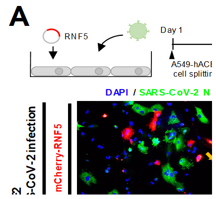 그림 3. 인간 폐 세포 내 RNF5를 발현시킨 결과 SARS-CoV-2 감염률이 줄어드는 결과