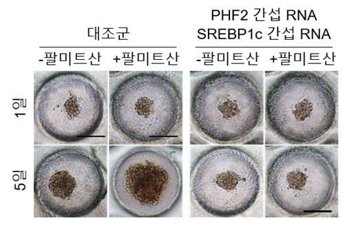 그림3. 팔미트산/PHF2/SREBP1c 이 간암세포 증식을 유도함