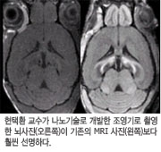 현택환 교수가 나노기술로 개발한 조명기로 촬영한 뇌사진(오른쪽)이 기존의 MRI사진(왼쪽)보다 훨씬 선명하다
