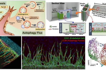 올간칩 기술과 단일세포 RNA 시퀀싱 기술 융합을 기반으로 혈관 신생 시 오토파지의 선택적 제어 기전 규명