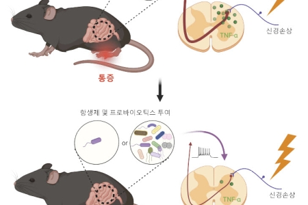 장내미생물에 의한 신경병증성 통증 조절