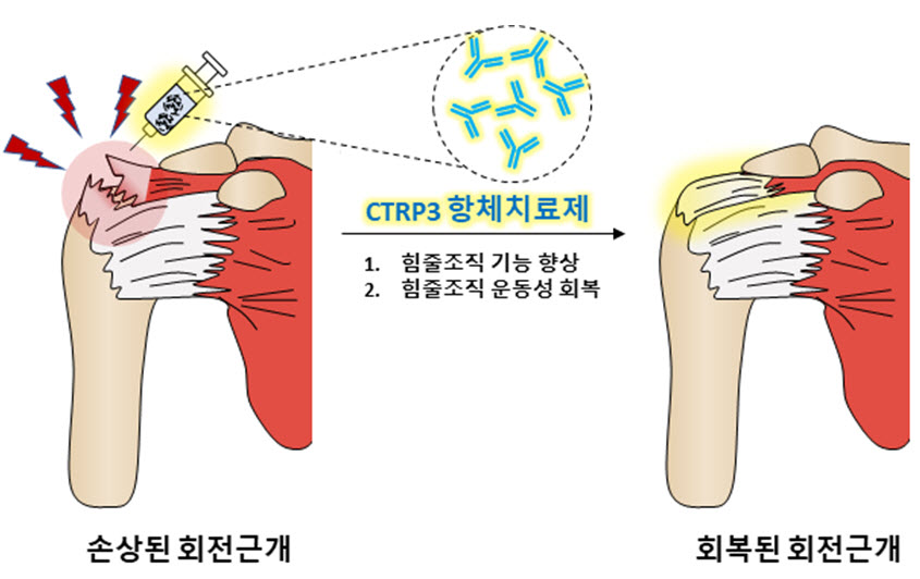 힘줄의 퇴행 및 파열은 주로 어깨에 존재하는 회전근개에서 빈번히 발생한다. 손상된 회전근개는 작은 충격에도 쉽게 파열까지 이어진다. 본 연구에서는 항체치료제를 이용하여 CTRP3를 저해하였을 때, 손상된 힘줄조직을 회복시켜, 기능을 향상시키고, 운동성을 회복하여 힘줄재생이 가능하다는 기전을 규명하였다.