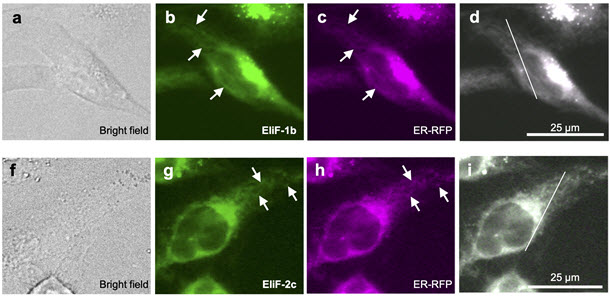 그림 3. EliF 분자가 소포체에 선택적으로 모여드는 현상을 보여주는 형광 이미징