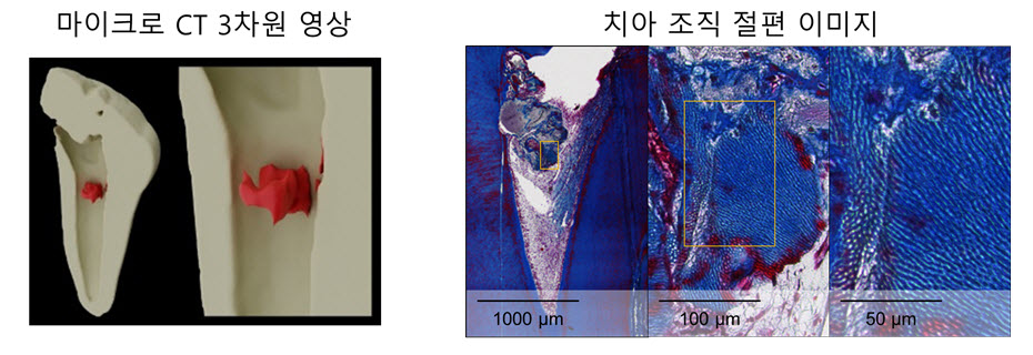 [그림] 동물 모델(개)을 활용한 치아 상아질 재생 유도 실험