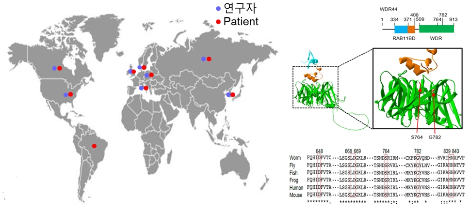 전세계 8개국 연구자들이 참여한 국제공동 연구를 통해 특정 증상들을 보이는 미진단 희귀질환 환자의 병인요인이 WDR44의 변이에 의한 섬모발달 이상이 원인임을 발혀냄