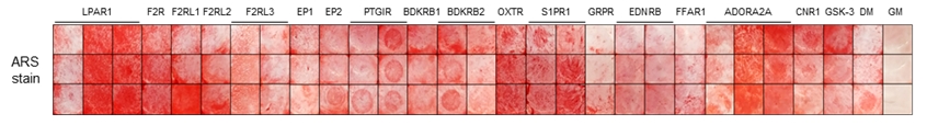 [그림 1: 경조직 재생 맞춤형 GPCR 스크리닝 과정 (위) 및 결과 (아래)]