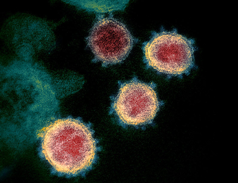 전자현미경으로 본 코로나 바이러스/출처: NIAID-RML