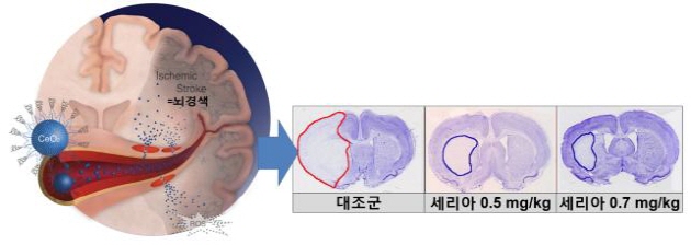 아래의 그림설명 참조