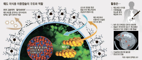 췌도 이식용 이중캡슐의 구조와 역할 이미지